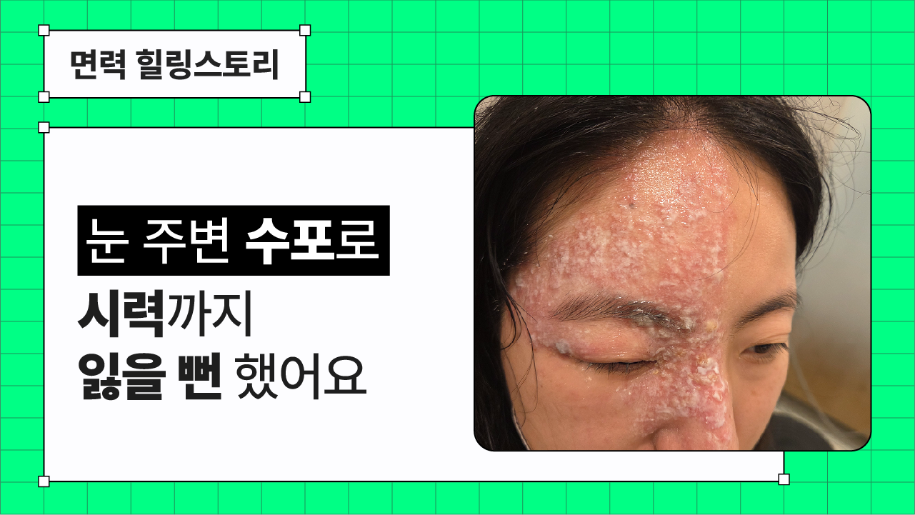 신경면역ㅣ시력까지 위협한 대상포진, 그 회복의 과정