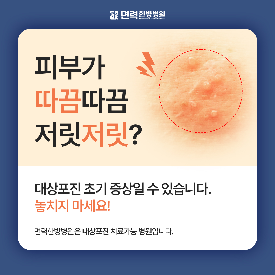 대상포진 초기치료