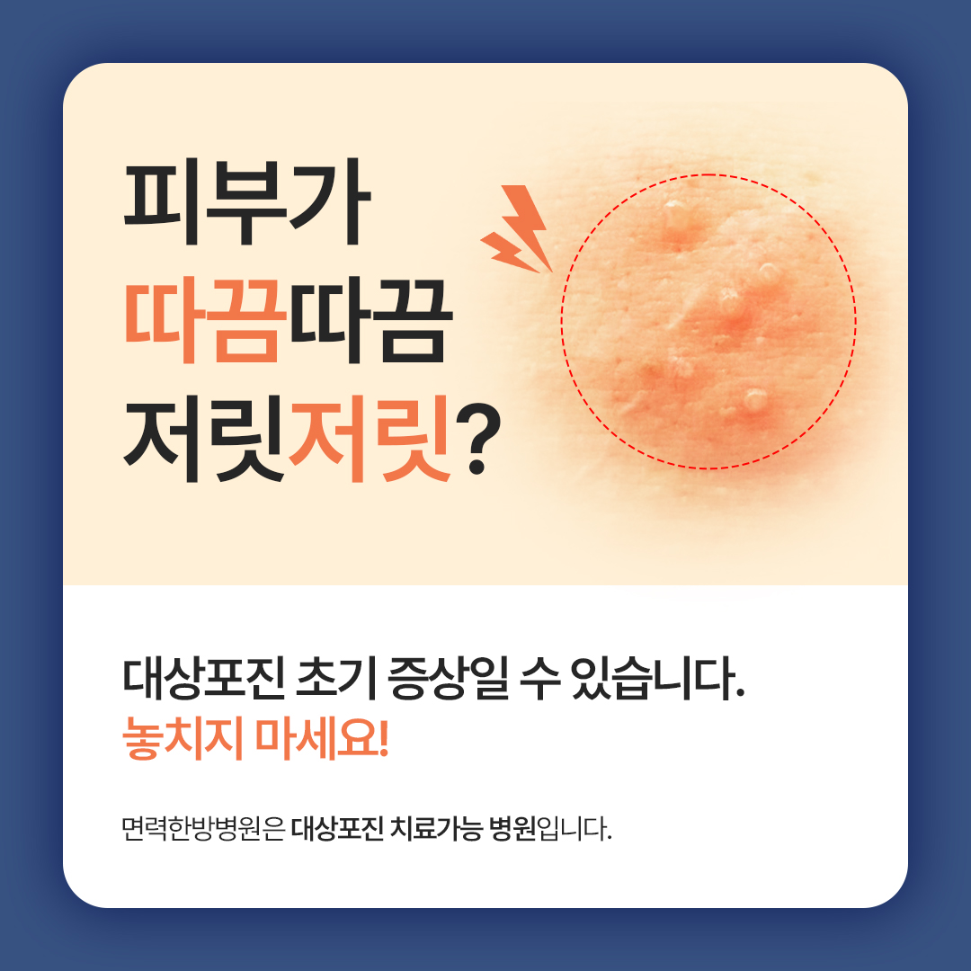 대상포진 초기치료